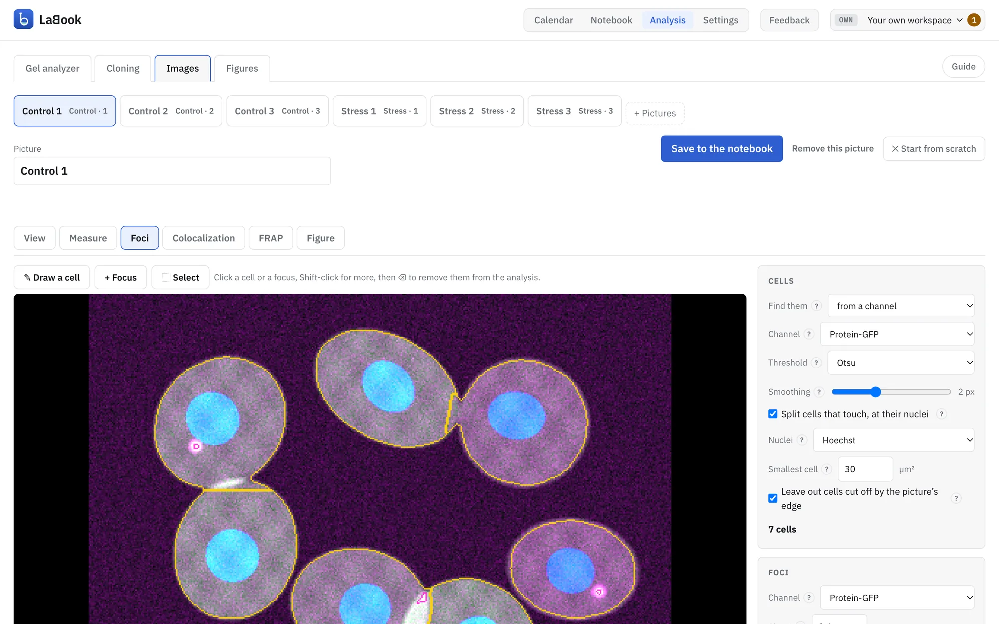 The Images tool counting foci: cells outlined in yellow over a three-channel picture, with the settings used to find them.